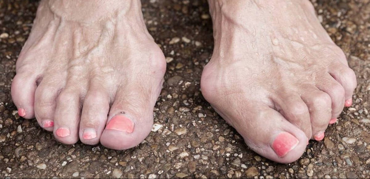 Stop torturing your feet in 